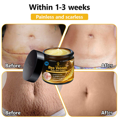 Hudros™ Bee Venom Body Skin Cream（🧑‍⚕️AAD Recommended)🔥