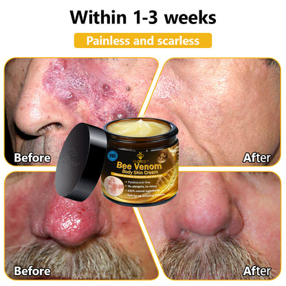 Hudros™ Bee Venom Body Skin Cream（🧑‍⚕️AAD Recommended)🔥